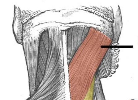 <p>thick back neck muscle (creates a V shape)</p>