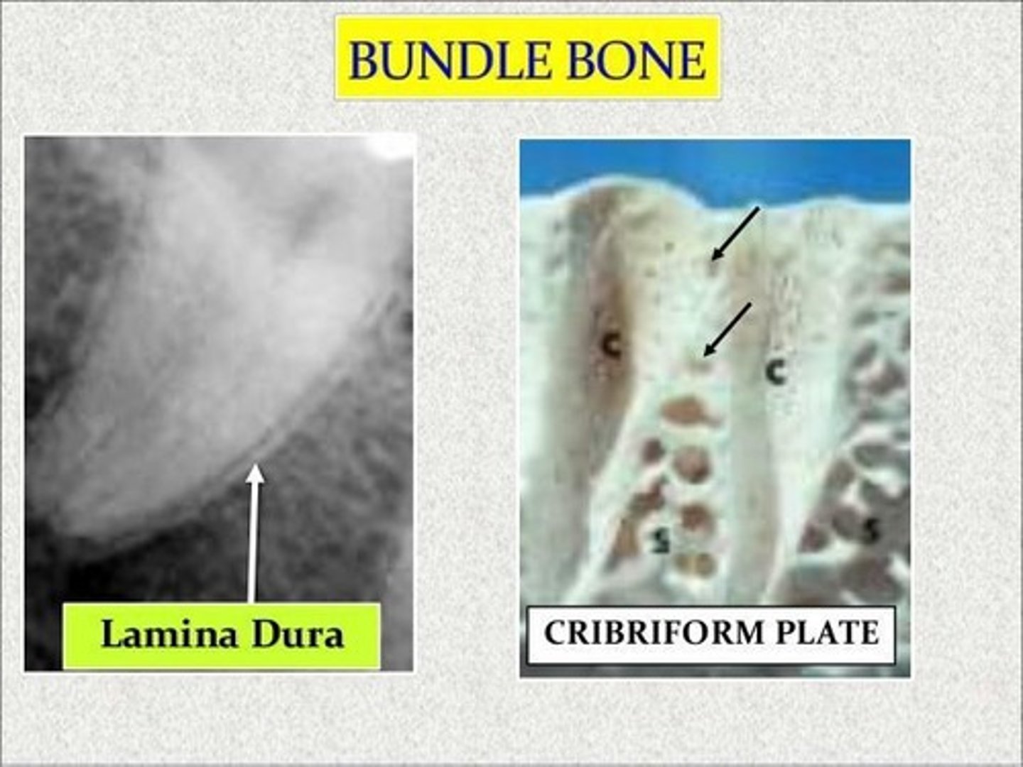<p>It appears radiopaque and is important for studying pathological lesions.</p>