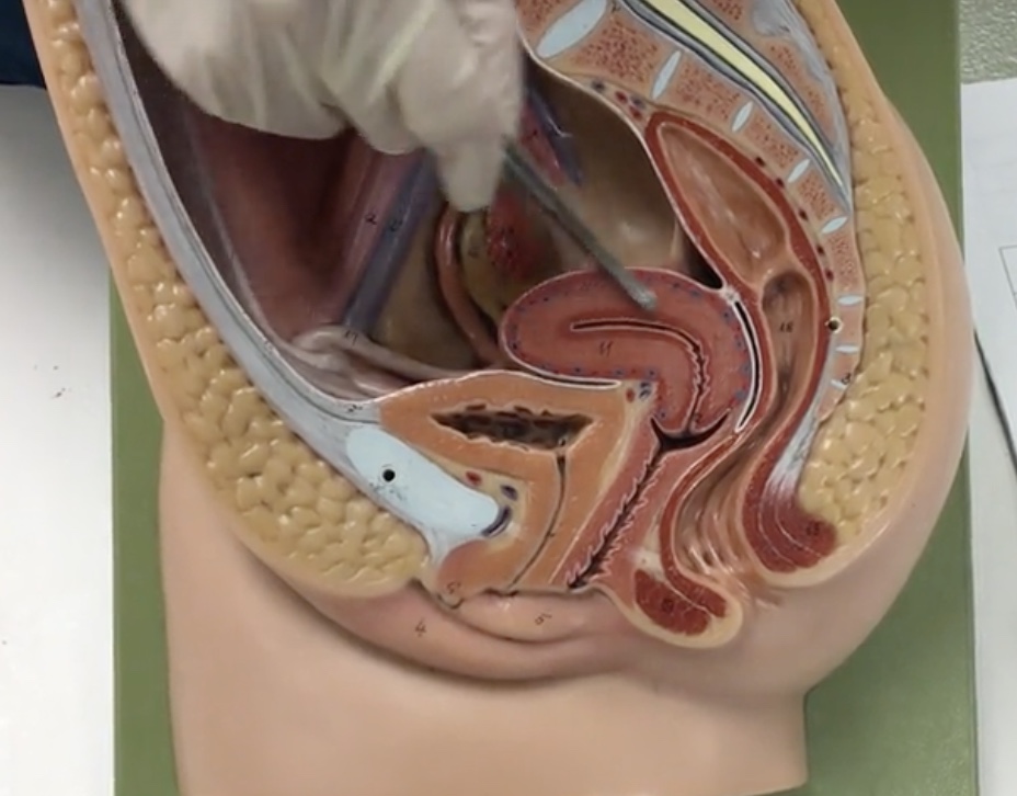 <p>Description: Narrow, middle portion of the uterus</p><p>Relationship: N/A</p>