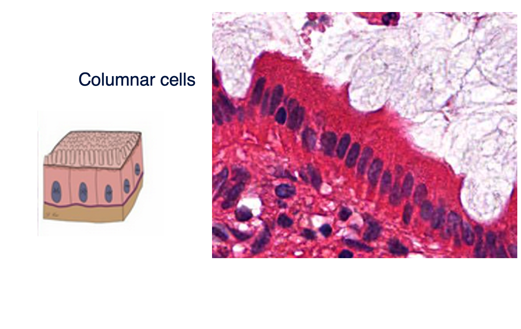 <p>Columnar cells</p>