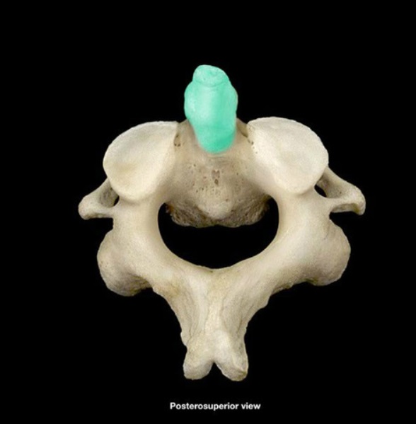 <p>Name this projection and the bone it is on</p>
