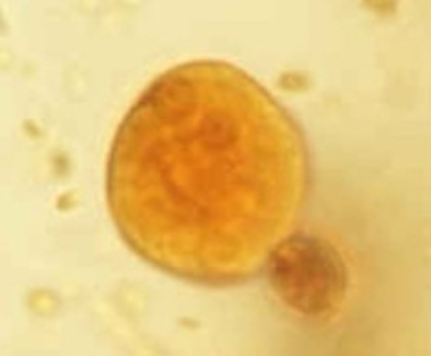 <p>Identify the parasite</p>
