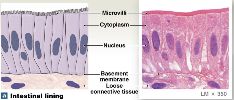 <p>tall slender cells</p><p>location: stomach lining, intestine, gallbladder</p><p>function: protection, secretion, absorption</p>
