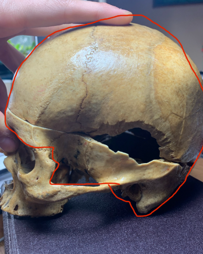 <p>8 Huesos</p><ul><li><p>Hueso occipital</p></li><li><p>2 Huesos parietales</p></li><li><p>Hueso frontal</p></li><li><p>Hueso etmoides</p></li><li><p>Hueso esfenoides</p></li><li><p>2 Huesos temporales</p></li></ul><p></p>