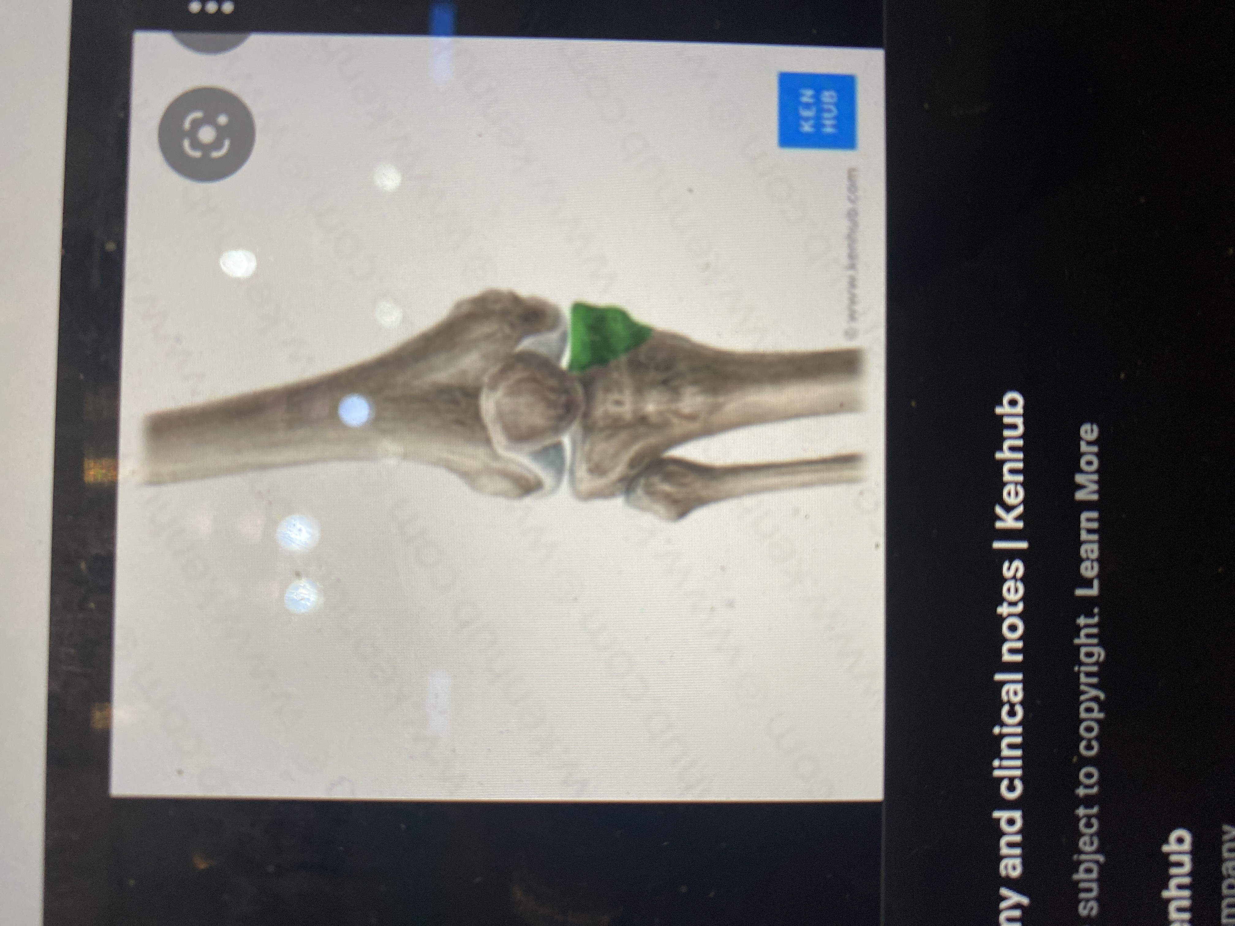 knowt flashcard image