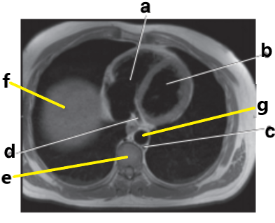 <p>What is letter e ?</p>