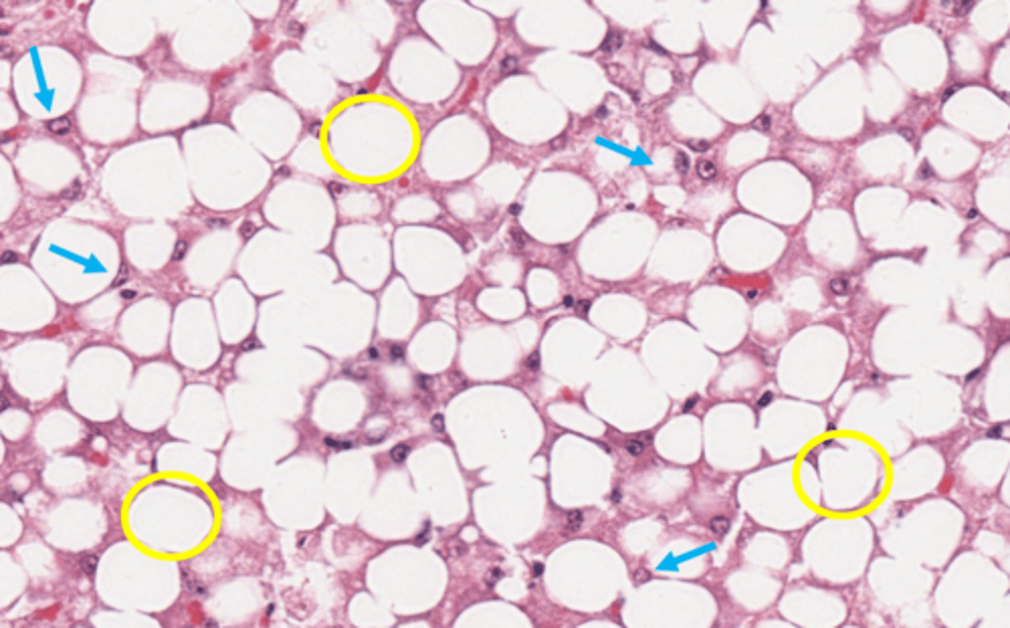 <p>yellow circle?</p>