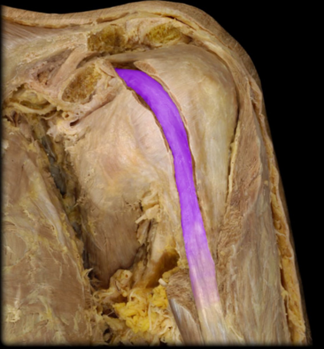 <p>What structure is shown?</p>