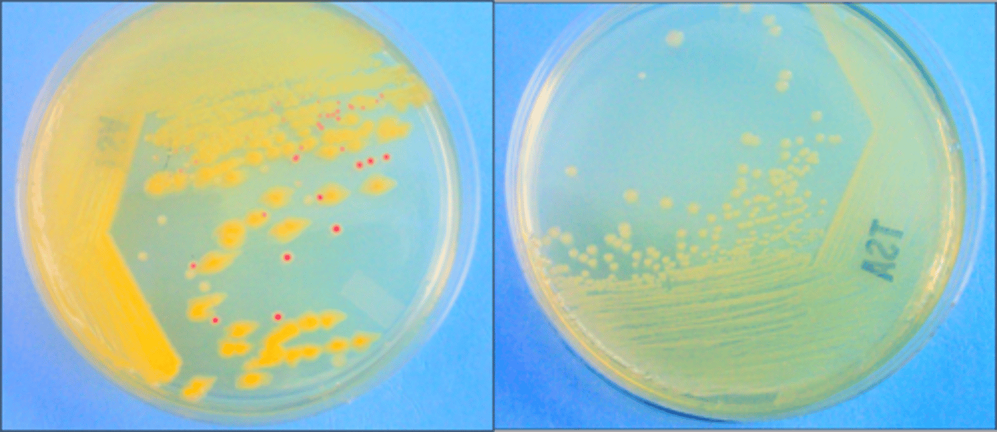 <p>These both come from the same broth. The first plate is the</p>