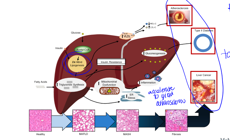 <p>atherosclerosis, type II diabetes, liver cancer, etc. this is why reducing fat synthesis is beneficial </p>