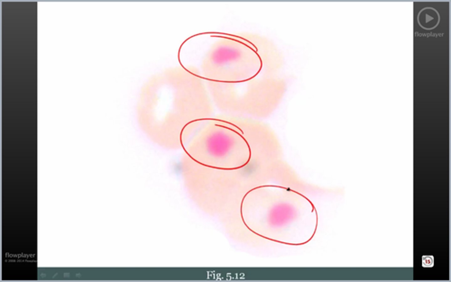 <p>HUH wtf rbc4? cause?</p>