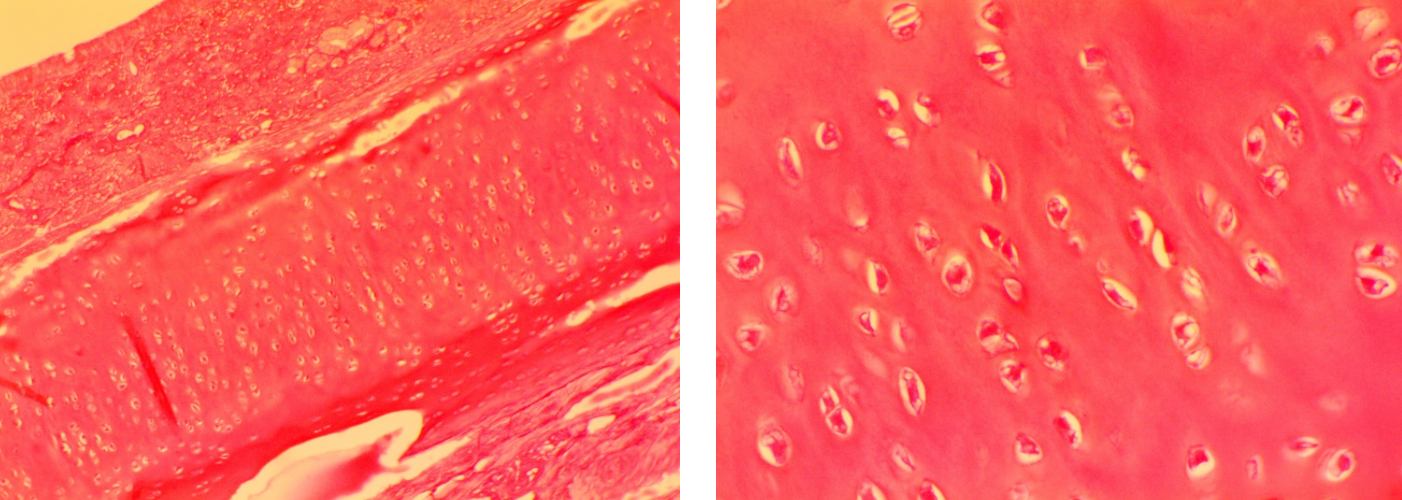 <p>Hyaline cartilage connective tissue</p>