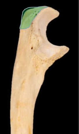 <p>What bone structure is this?</p>