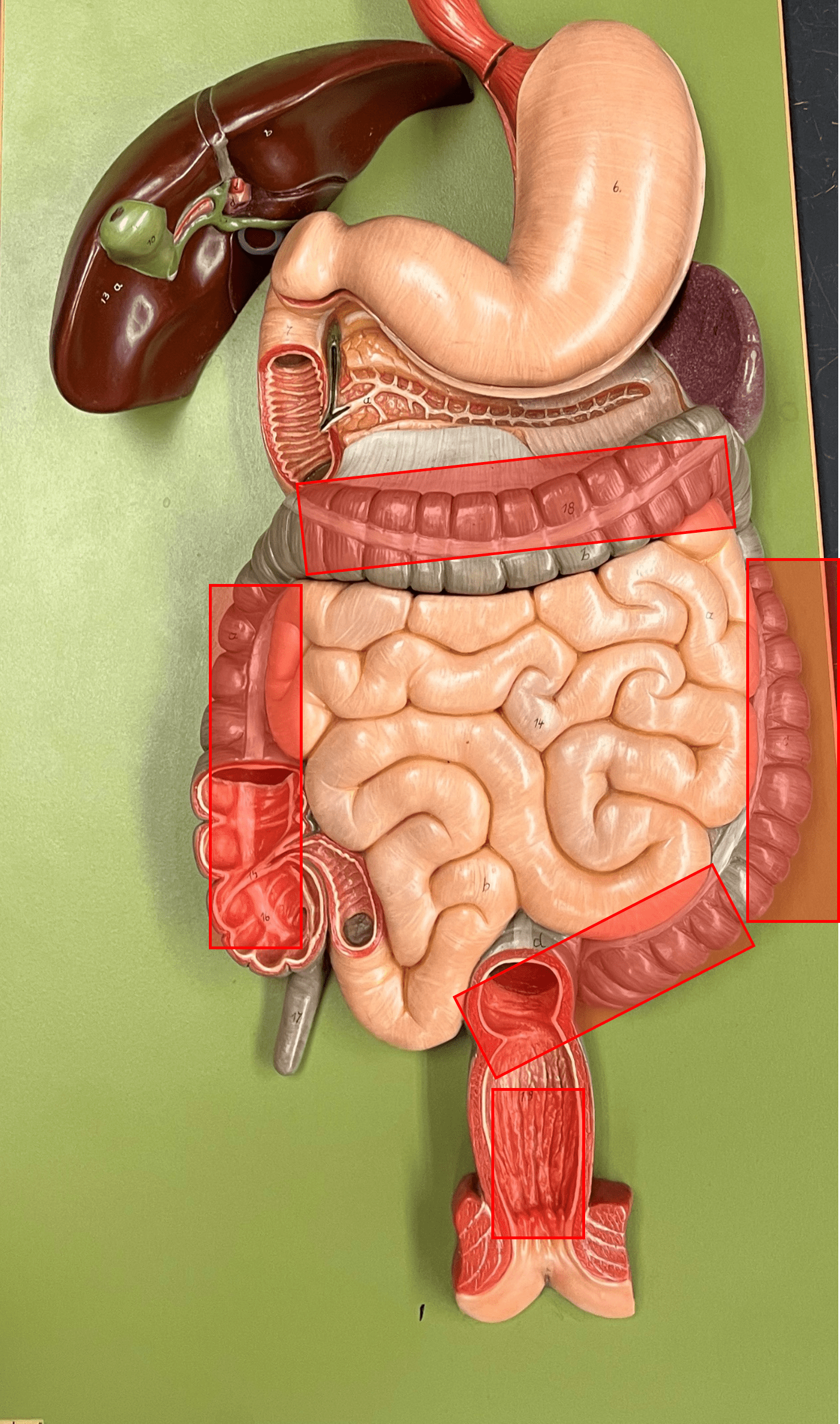 • A tube-shaped organ.

• Divided into the cecum, colon, and rectum.

• Site of feces formation.