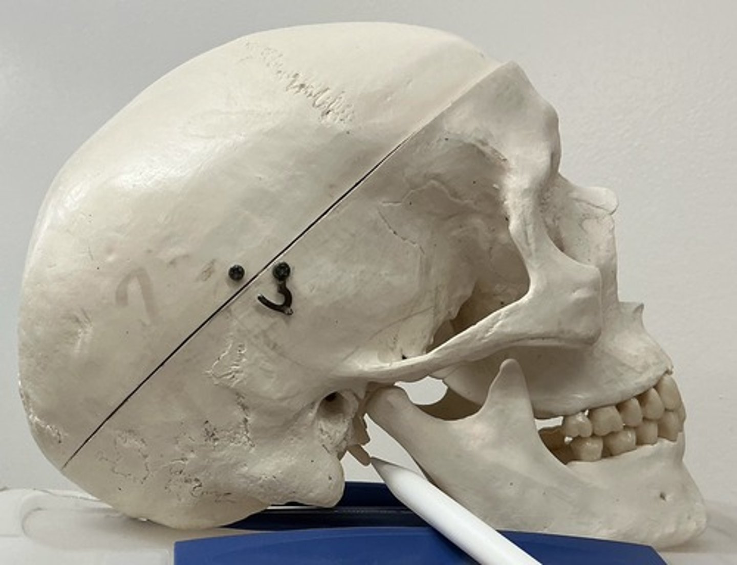 <p>What is the arrow pointing to?</p>