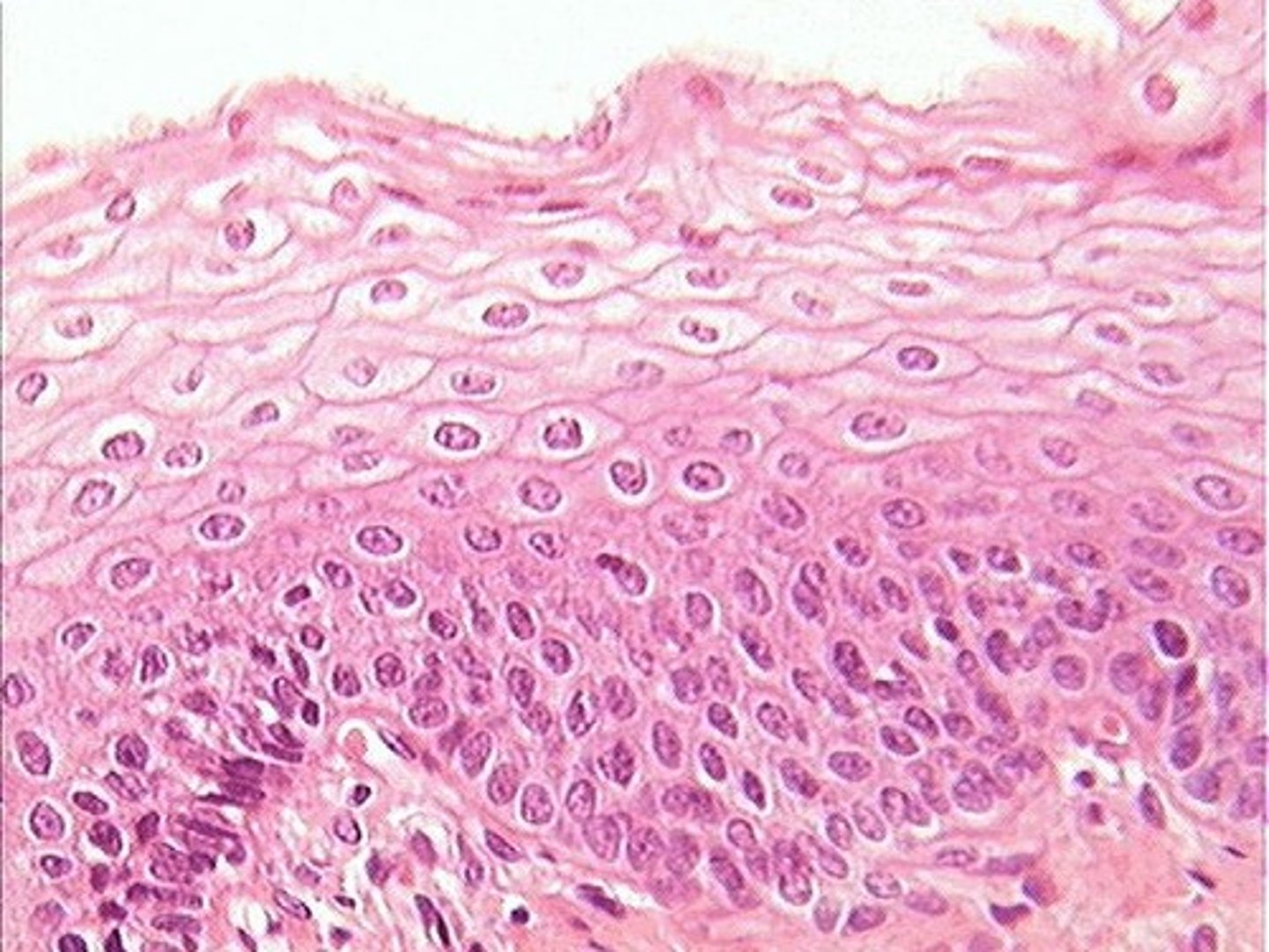 <p>flat, scale-like epithelial cell</p><p>Protective surfaces</p><p>• Examples: skin, esophagus</p><p>• Smaller and easier to replace than cuboidal or columnar cells</p><p>• Thin membranes</p><p>• Examples: alveoli, capillaries</p><p>• Allow for faster diffusion and passive transport</p>