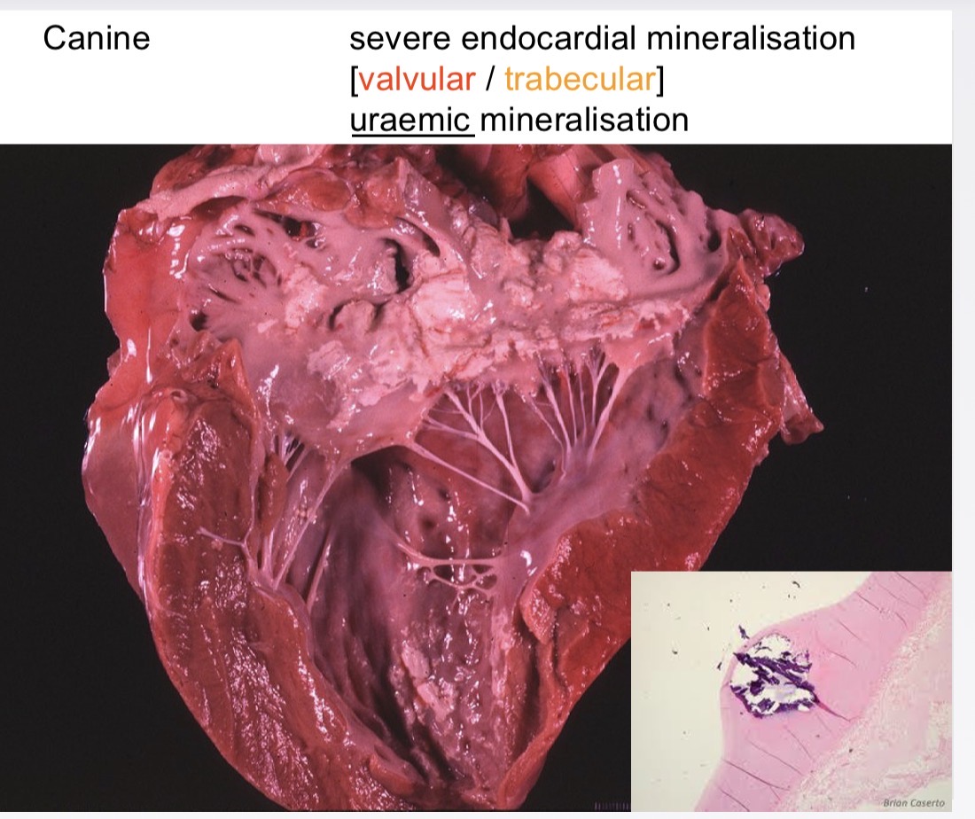 <p>endocardial diseases- mineralization causes</p>