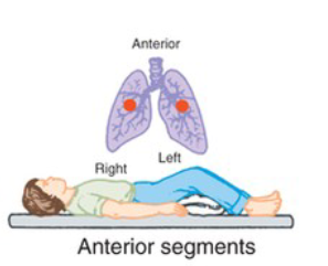 <p>What CPT position is pictured, and when is it used?</p>