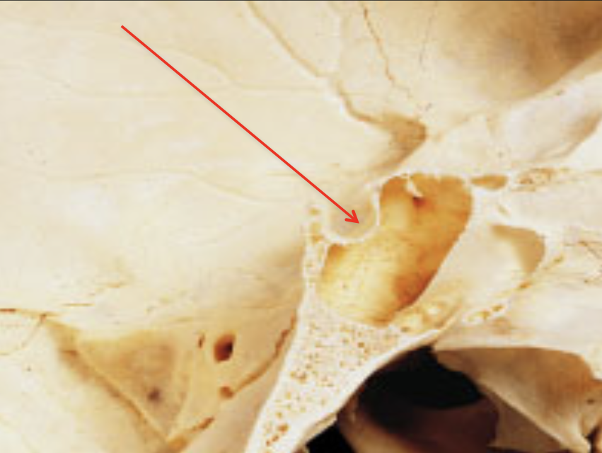term image