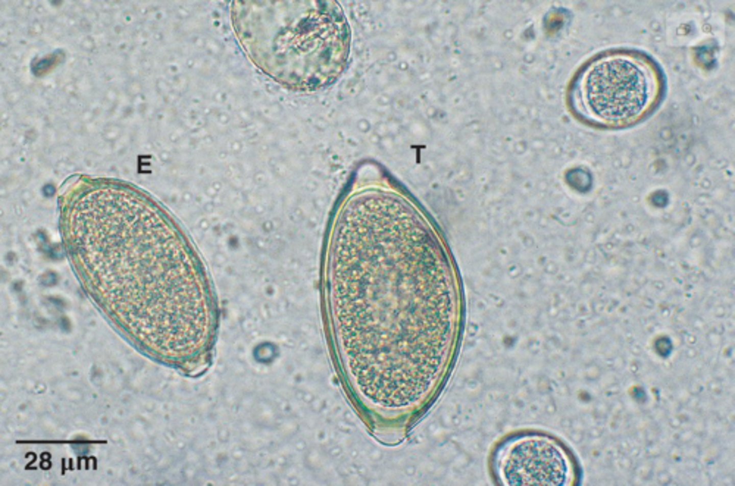 <p>What parasite is T if it is from a dog</p>