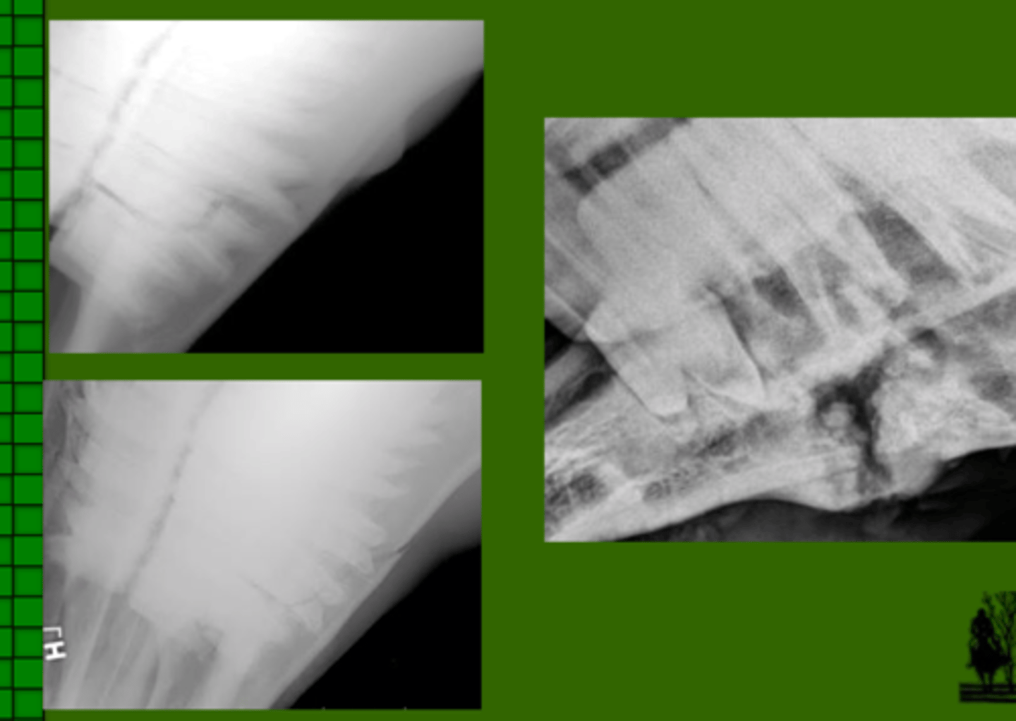 <p>Identify the pathology?</p>