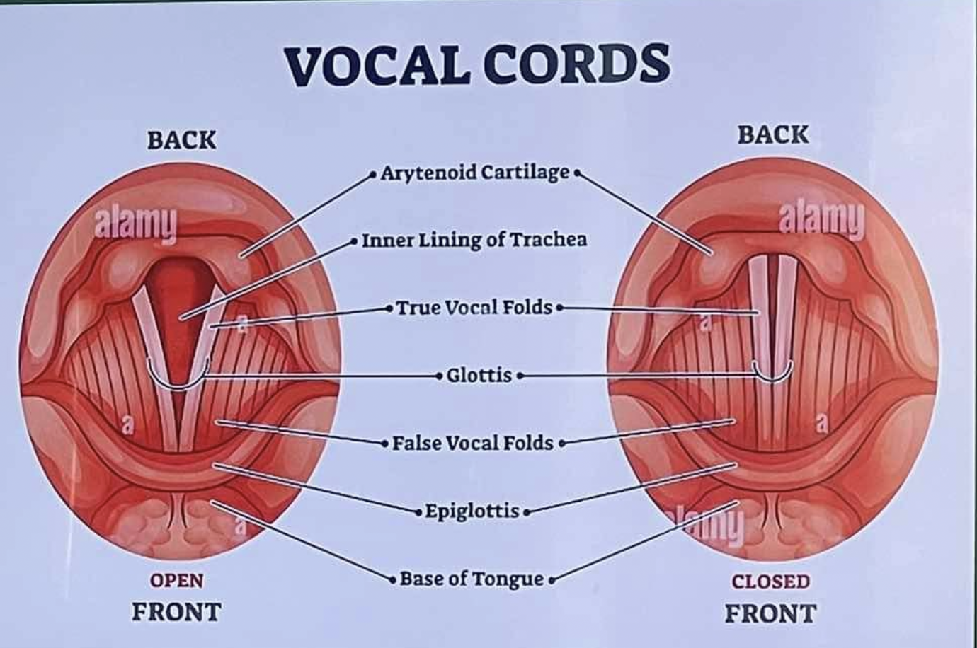 <p>What are the True Vocal Cords of the Larynx?</p>