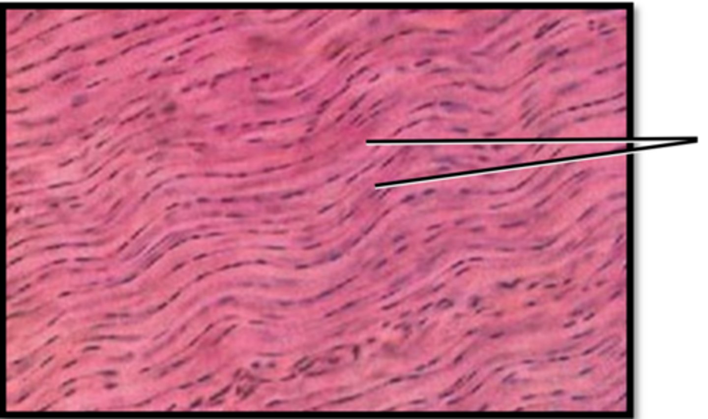 <p>What type of fibers are these?</p>
