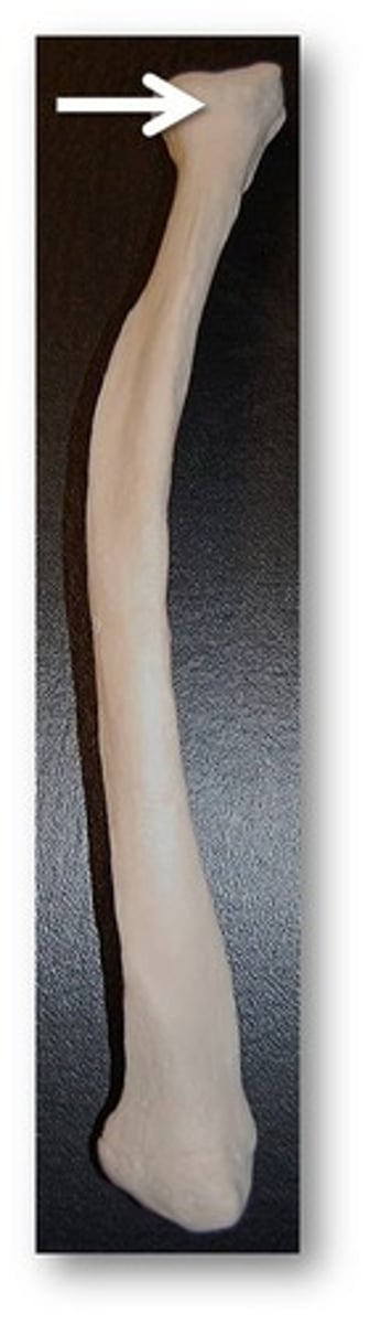 <p>Proximal end of fibula</p>