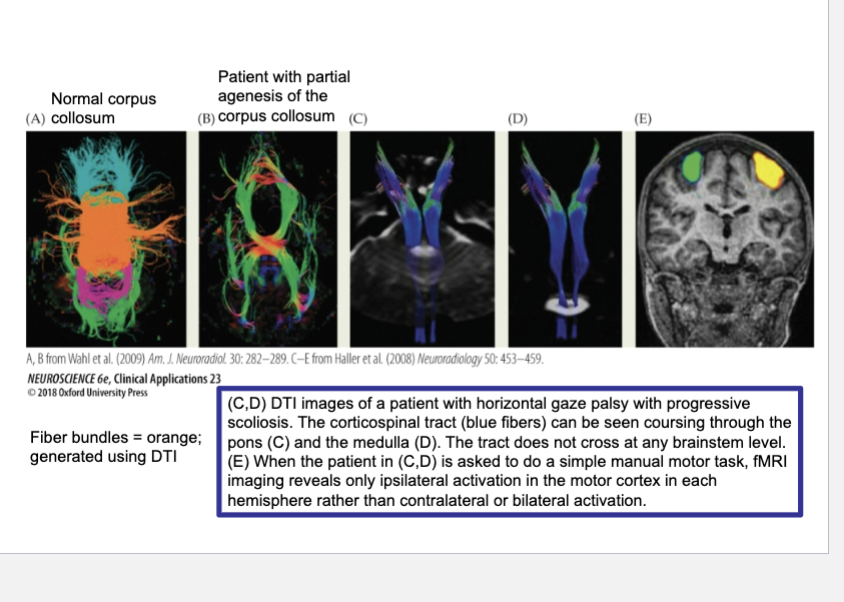 <p>CLINICAL APPLICATIONS&nbsp; Axon Guidance Disorders</p>
