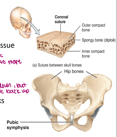 <ul><li><p>the presence of the absence of a joint cavity and the type of tissue connecting two bones</p></li><li><p>there are three structural classifications of joints</p><ol><li><p><strong>fibrous joints</strong></p><ul><li><p>no joint cavity, composed of fibrous connective tissue</p></li><li><p>ex. sutures on the skull</p></li><li><p>fibers create the joint</p></li><li><p>fibrous characteristic because don’t need to move</p></li></ul></li><li><p><strong>cartilaginous joints</strong></p><ul><li><p>no joint cavity, composed of cartilage </p></li><li><p>ex. pubic symphysis and intervertebral disks</p></li><li><p>jump → compress down, but then come back up</p></li></ul></li><li><p><strong>synovial joints</strong></p><ul><li><p>contain a joint cavity filled with synovial fluid</p></li><li><p>bones are held together by a joint cavity and associated ligaments</p></li><li><p>all diarthrotic joints are synovial joints (freely move)</p></li><li><p>ex. knee, shoulder, hip, elbow</p></li></ul></li></ol></li></ul><p></p>