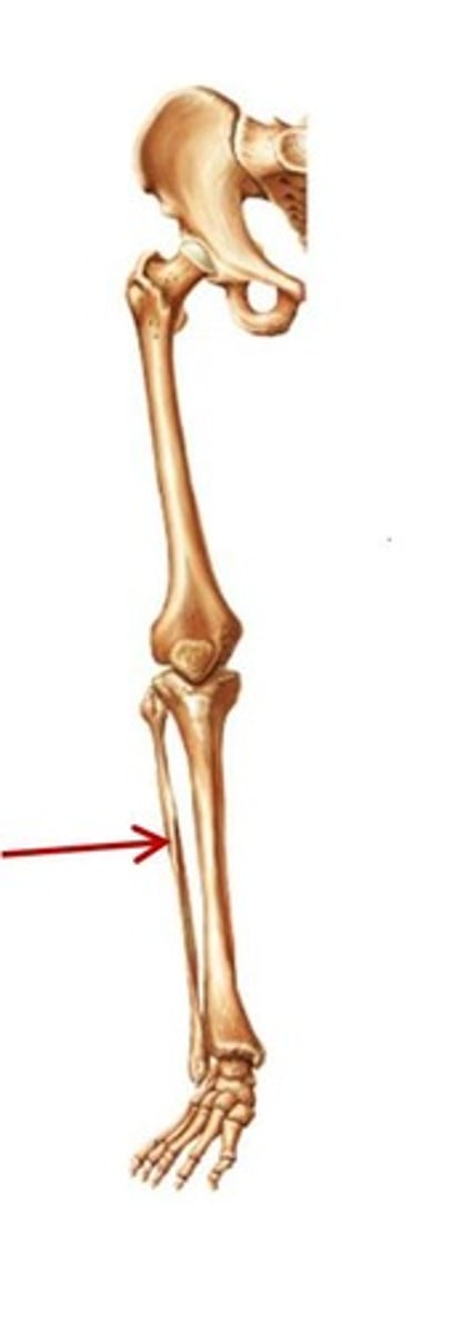 <p>ID bone</p>