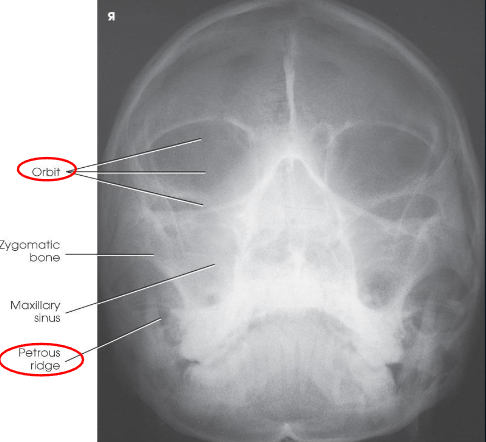 <ul><li><p>shows orbits, maxillae, and zygomatic arches</p></li><li><p>entire orbits and facial bones</p></li><li><p>no rotation or tilt:</p><ul><li><p>distances between the lateral borders of the skull and the orbits</p></li><li><p>MSP of head aligned with long axis of collimated field</p></li></ul></li><li><p>petrous ridges just below maxillary sinuses</p></li></ul><p></p>