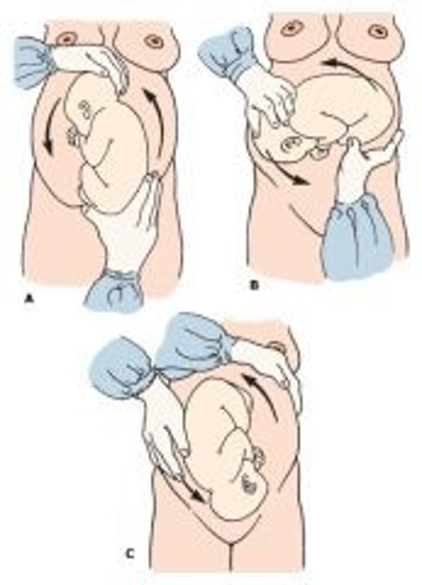 <p>act of turning</p>