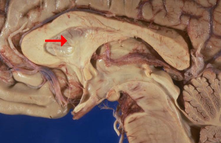 <p>Label this brain part</p>