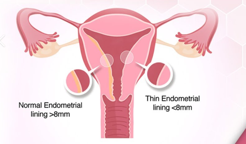 <ol><li><p><span style="color: rgb(233, 61, 61);"><strong>suppress ovulation</strong></span></p></li><li><p><span style="color: rgb(137, 105, 226);"><strong>thicken cervical mucus</strong></span> (makes it harder for sperm to pass through)</p></li><li><p><span style="color: rgb(75, 185, 23);"><strong>thins uterine lining</strong></span></p></li></ol><p></p>
