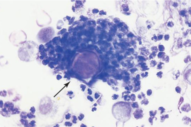 term image