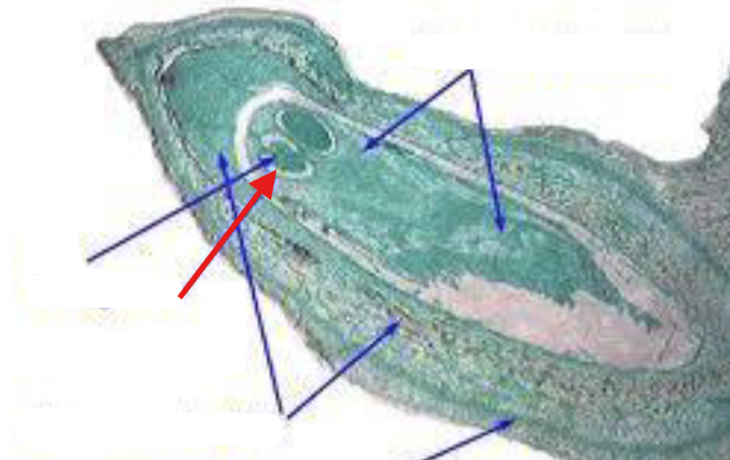 <p>What is being indicated on the Pinus Mature Ovule?</p>