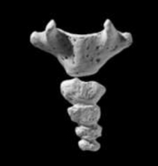 <p>Colloquially referred as tail bone</p>