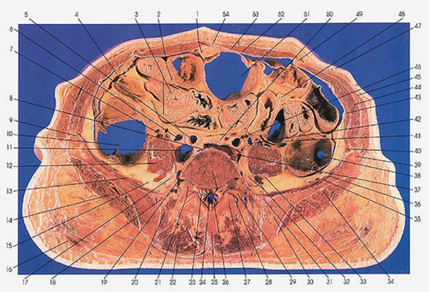 <p>Cross Section</p>