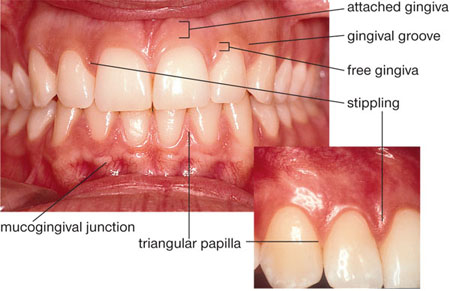 <p>Located below the sulcus, this line separates the free gingiva and the attached gingiva </p>