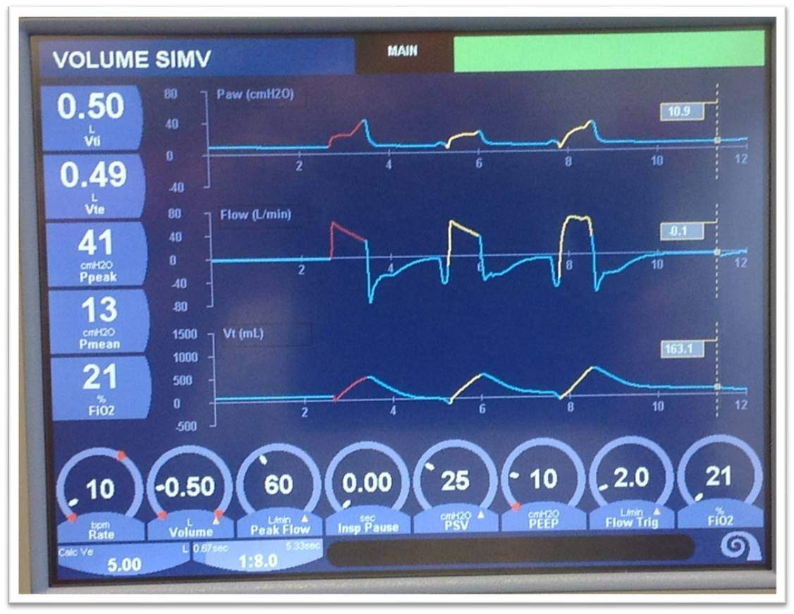 <p>What are <strong>patient monitors? What do they do?</strong></p>