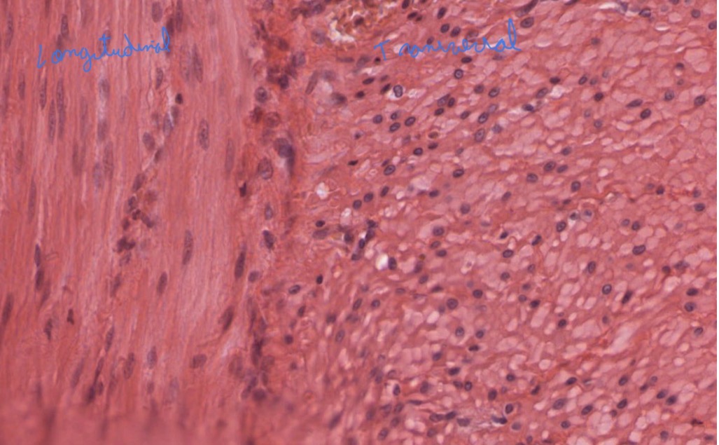 <p>Tejido Muscular Liso</p>