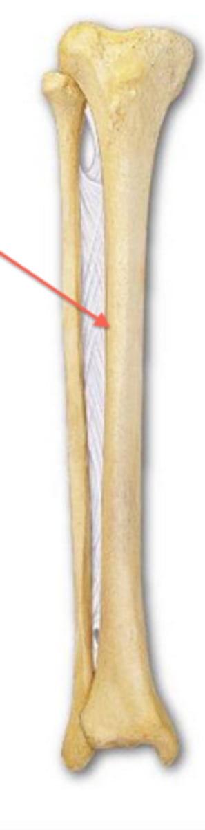 <p>Name the structure.</p>