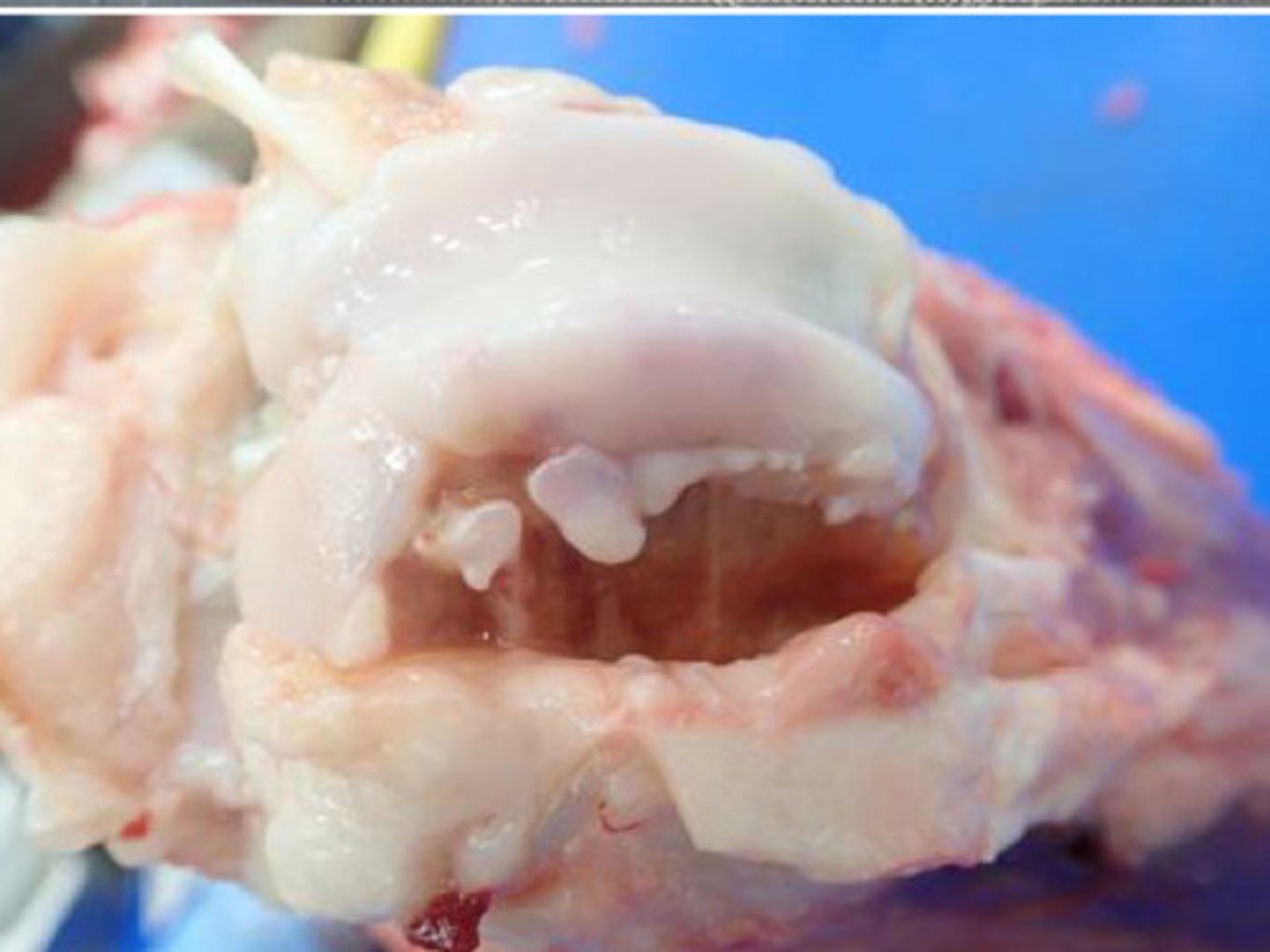 <p>Identify the pathology:</p>