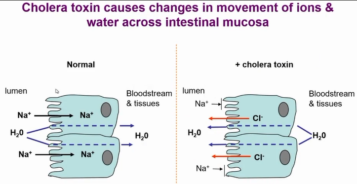 <p>resulrs in changes in the movement of ions and water across intestinal mucosa - cl- out and NA+ blocked from entering </p><p>results in massive loss of water from cells</p>