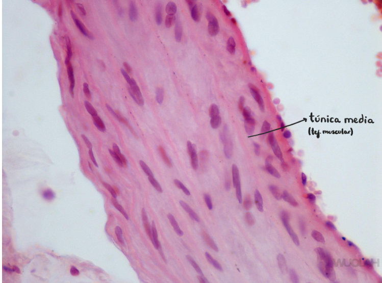 <p>Arteria pulmonar (muscular)</p><p>Túnica media - con fibras musculares lisas dispuestas helicoidalmente</p>