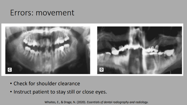 <p>Error: movement</p>