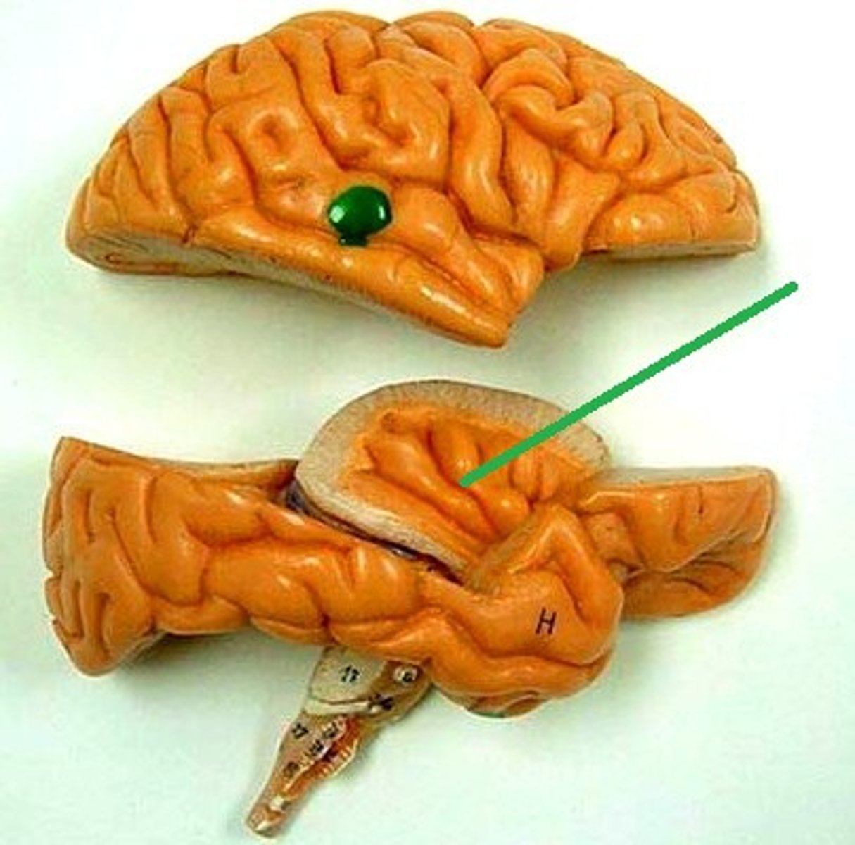 <p>ID lobe</p>