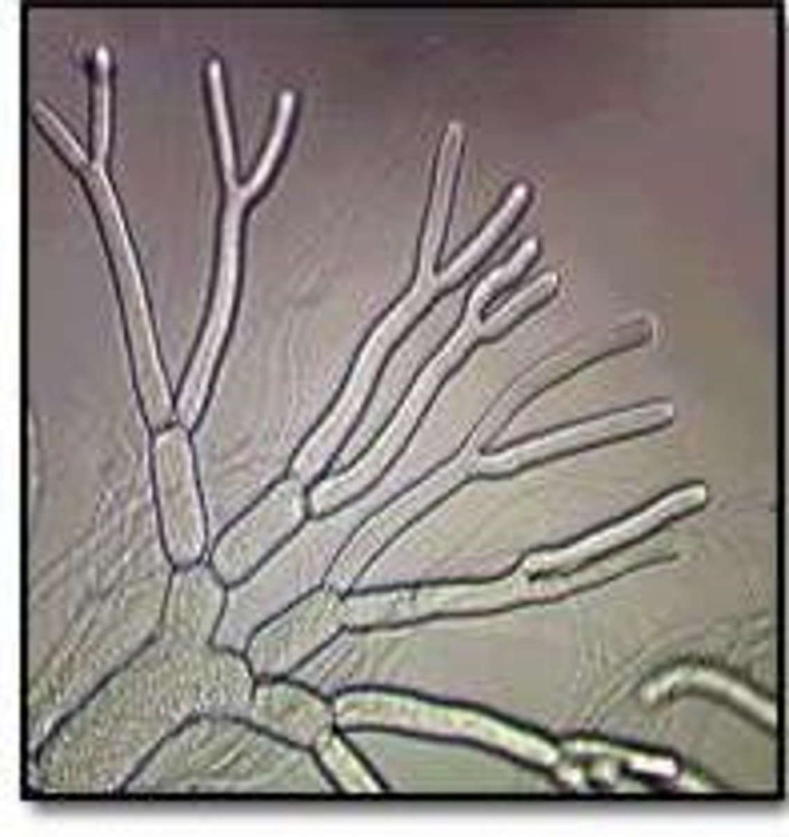 <p>tiny filaments that make up the body of multicellular fungi</p>