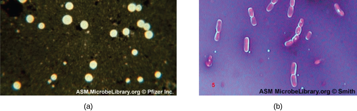 <p><strong>A:</strong> The <strong>cell body</strong> is stained with a <strong>positive stain</strong>, and the <strong>background</strong> with a <strong>negative stain</strong>, leaving a <strong>clear halo</strong> for the capsule.</p>